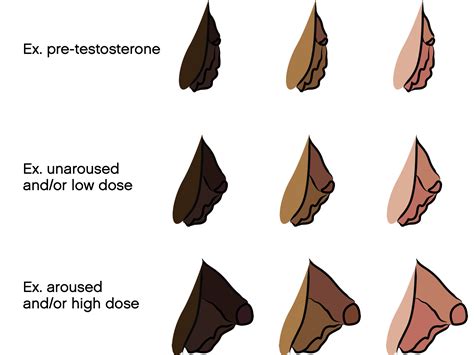 bottom growth ftm|Bottom Growth and Genital Changes on Testosterone。